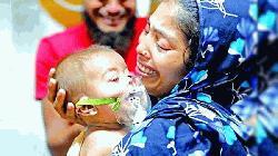 হাম ও উপসর্গে আরও ৬ শিশুর মৃত্যু, নতুন আক্রান্ত ১৪৪৫