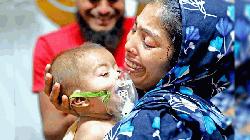 হামের উপসর্গে আরও ১৬ শিশুর মৃত্যু, আক্রান্ত ১৪৩৪