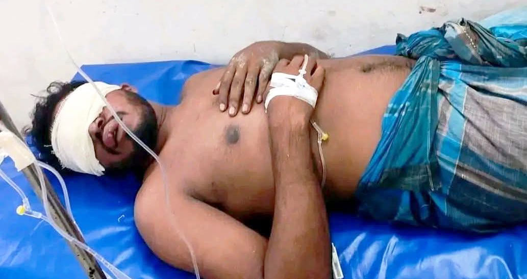 মাইক্রোবাসে তুলে নিয়ে যুবকের দুই চোখ উপড়ে ফেলার অভিযোগ