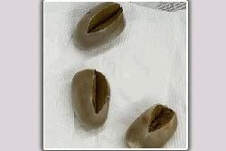 সোনার ডিম আনা আসামি আরমান ৫ দিনের রিমান্ডে